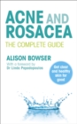 Acne and Rosacea : The Complete Guide - Book