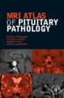 MRI Atlas of Pituitary Pathology - eBook