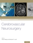 Cerebrovascular Neurosurgery - Book