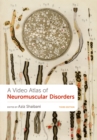 A Video Atlas of Neuromuscular Disorders - eBook