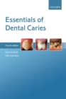 Essentials of Dental Caries - Book