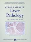Colour Atlas of Liver Pathology - Book