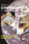 Atlas of Contraception - eBook