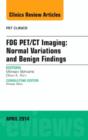 FDG PET/CT Imaging: Normal Variations and Benign Findings - Translation to PET/MRI, An Issue of PET Clinics - Book