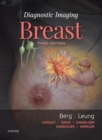 Diagnostic Imaging: Breast E-Book : Diagnostic Imaging: Breast E-Book - eBook