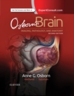 Osborn's Brain E-Book : Osborn's Brain E-Book - eBook
