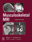 Musculoskeletal MRI E-Book - eBook