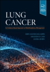 Lung Cancer : An Evidence-Based Approach to Multidisciplinary Management - Book