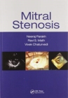 Mitral Stenosis - Book