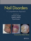 Nail Disorders : A Comprehensive Approach - Book