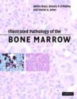 Illustrated Pathology of the Bone Marrow - eBook