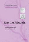Uterine Fibroids : Embolization and other Treatments - Book