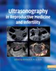 Ultrasonography in Reproductive Medicine and Infertility - Book