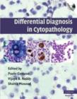 Differential Diagnosis in Cytopathology with CD-ROM - Book