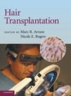 Hair Transplantation - Book