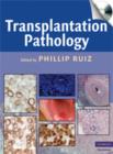 Transplantation Pathology - Book