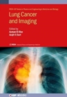 Lung Cancer and Imaging - Book
