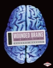 Wounded Brains : True Survival Stories - eBook