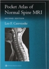 Pocket Atlas of Spinal MRI - Book