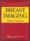Breast Imaging - Book
