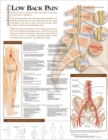 Understanding Low Back Pain Anatomical Chart - Book