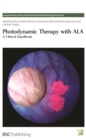 Photodynamic Therapy with ALA : A Clinical Handbook - Book