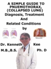 Simple Guide to Pneumothorax (Collapsed Lungs), Diagnosis, Treatment and Related Conditions - eBook