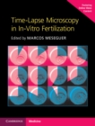 Time-Lapse Microscopy in In-Vitro Fertilization Hardback with Online Resource - Book