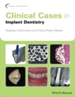 Clinical Cases in Implant Dentistry - Book