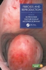 Fibroids and Reproduction - Book
