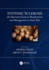Systemic Sclerosis : An Illustrated Guide to Manifestation and Management in Asian Skin - Book