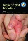 Pediatric Nail Disorders - Book