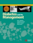 Diabetes and Its Management - Book