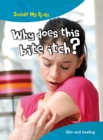 Why does this Bite Itch? - Book