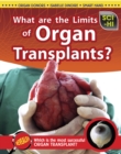 What Are the Limits of Organ Transplantation? - Book