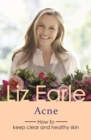 Acne : How to keep clear and healthy skin - eBook