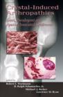 Crystal-Induced Arthropathies : Gout, Pseudogout and Apatite-Associated Syndromes - eBook