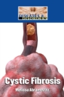 Cystic Fibrosis - eBook