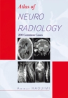 Atlas of Neuroradiology : 200 Common Cases - eBook