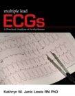Multiple Lead ECGs : A Practical Analysis of Arrhythmias - Book
