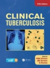 Clinical Tuberculosis - Book