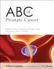 ABC of Prostate Cancer - Book