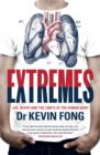 Extremes : Life, Death and the Limits of the Human Body - eBook