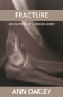 Fracture : Adventures of a broken body - eBook