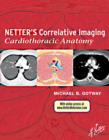 Netter's Correlative Imaging: Cardiothoracic Anatomy - eBook
