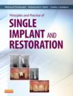 Principles and Practice of Single Implant and Restoration - Book