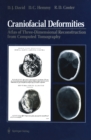Craniofacial Deformities : Atlas of Three-Dimensional Reconstruction from Computed Tomography - eBook