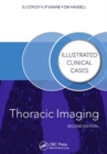 Thoracic Imaging : Illustrated Clinical Cases, Second Edition - Book