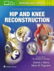 Illustrated Tips and Tricks in Hip and Knee Reconstructive and Replacement Surgery - Book