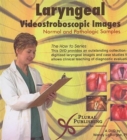 Laryngeal Videostroboscopic Images : Normal and Pathologic Samples - Book